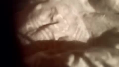 Snapshot of moos1 chatting on February 28, 2026, 9:05 pm moos1 online show from February 28, 2026, 9:05 pm